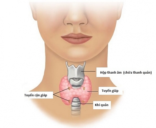 Dấu hiệu nhận biết ung thư tuyến giáp