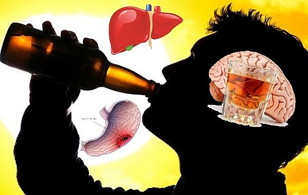 Chuyên gia cảnh báo nguy hại khi giới trẻ sử dụng rượu, bia