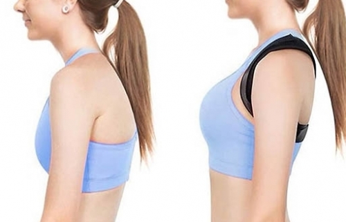 Cô gái 22 tuổi gù lưng vì phải đeo ngực khủng