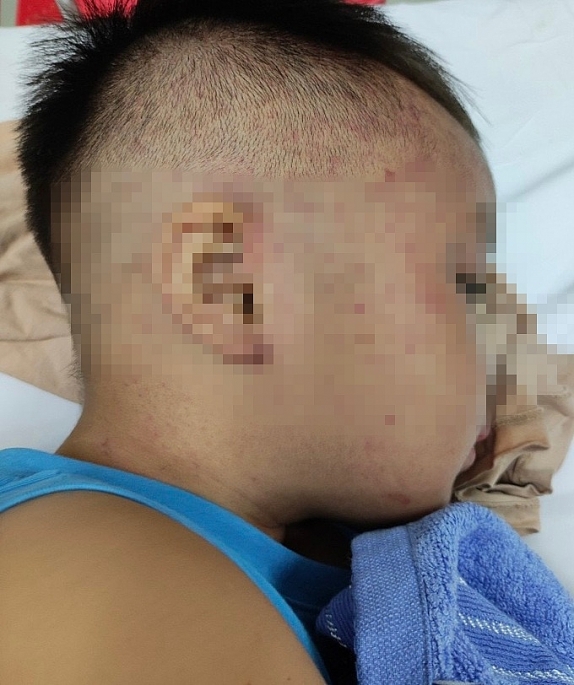 Tạm giữ nghi phạm bạo hành bé trai 3,5 tuổi ở Hà Nam