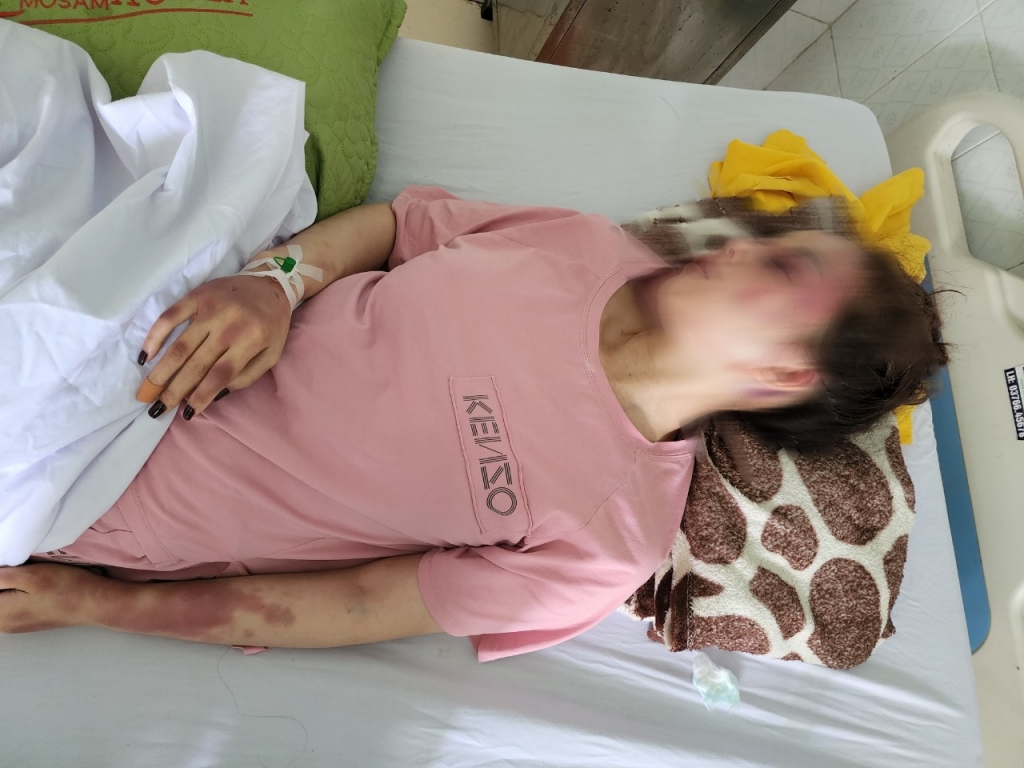 Nạn nhân hiện vẫn đang được theo dõi và điều trị tại bệnh viên Đa khoa tỉnh Thanh Hóa với tình trạng đa chấn thương