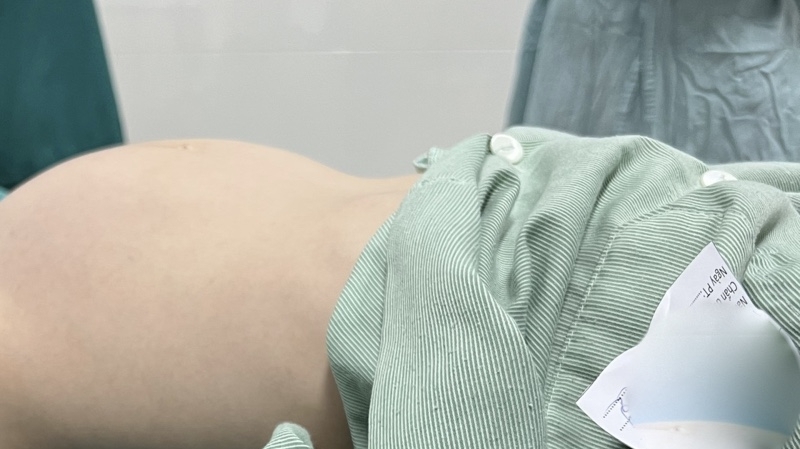 Đi khám vì đau bụng, bé gái được phát hiện mang khối u buồng trứng khổng lồ