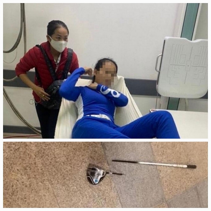 Chị N.A.L là nhân viên phục vụ sân golf BRG Đà Nẵng phải nhập viện sau khi bị đập cây gậy golf vào người