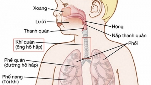 Căn bệnh cực nguy hiểm ở trẻ nhỏ dễ nhầm lẫn với bệnh viêm phổi