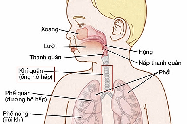 Căn bệnh cực nguy hiểm ở trẻ nhỏ dễ nhầm lẫn với bệnh viêm phổi