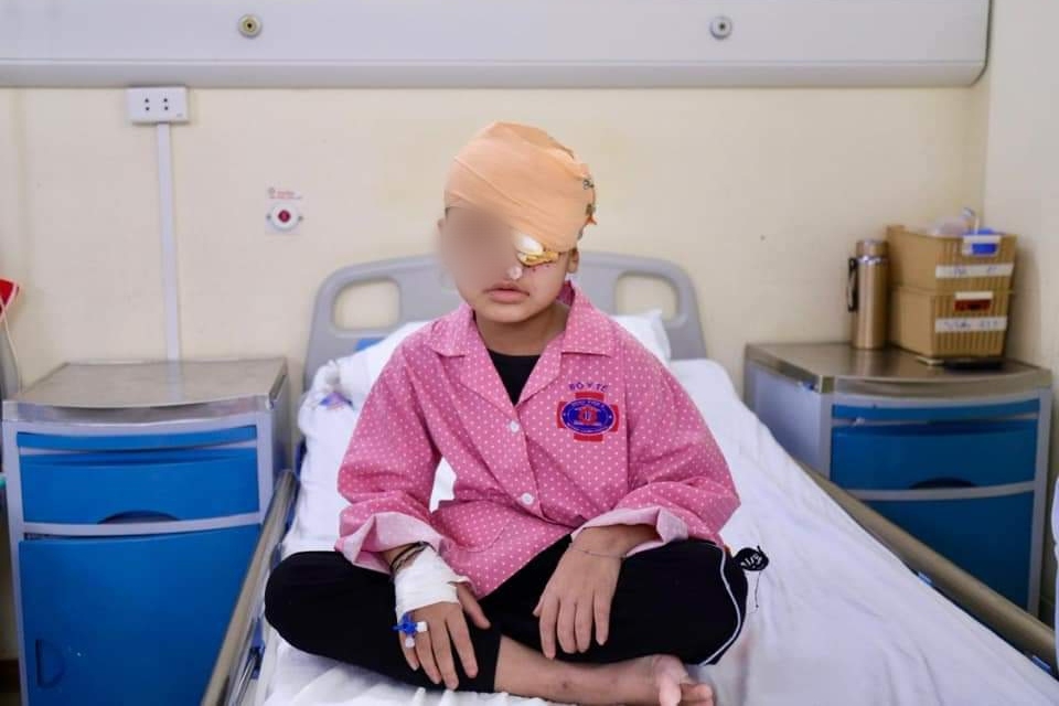 Xót xa cậu bé 4 tuổi có u quái hốc mắt, nhiều bệnh viện từ chối mổ