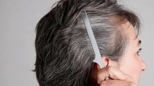 Những biện pháp ngăn ngừa tóc bạc sớm