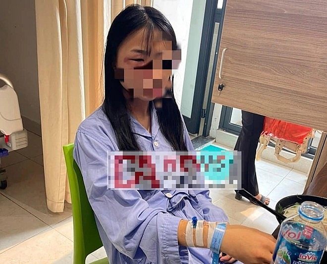 Nữ sinh đang là học sinh lớp 8 trường THCS Xuân Nộn, huyện Đông Anh bị đánh hội đồng, khiến em bị chấn thương, phù nề vùng mặt và phải nhập viện điều trị