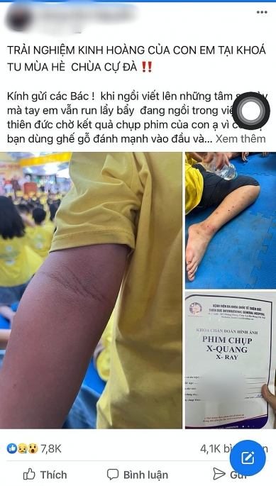 -	Chị G.N.N đăng tải thông tin về “trải nghiệm kinh hoàng” của con trai mình tại chùa Cự Đà. Ảnh chụp màn hình trang cá nhân chị G.N.N