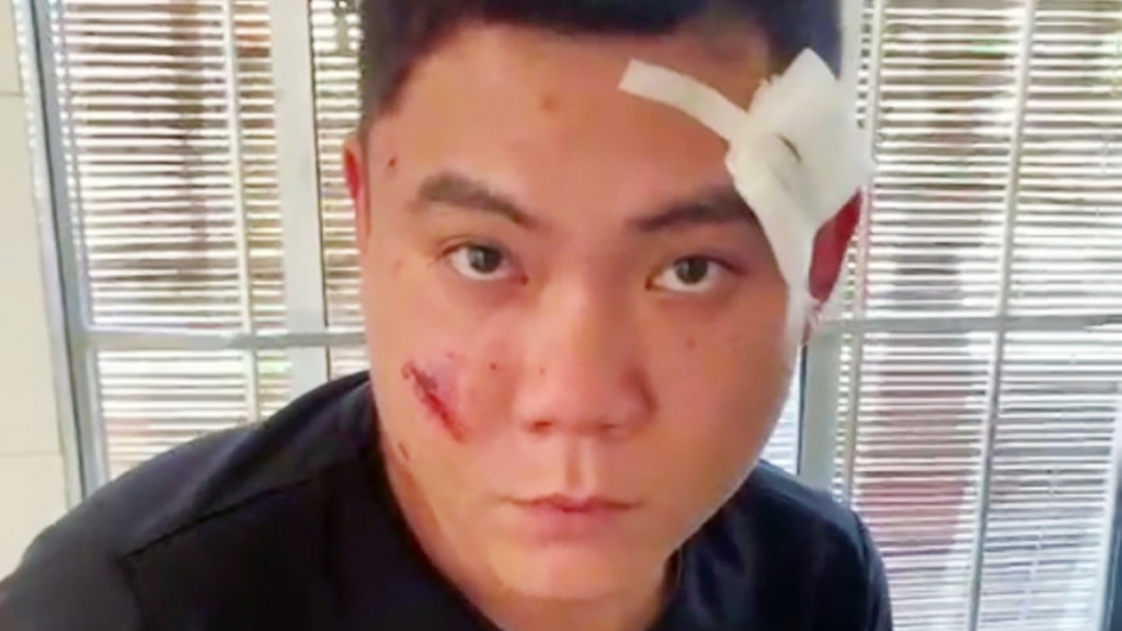 Vụ nổ súng ở Khánh Hòa khiến 2 người bị thương: Sẽ khởi tố đối tượng về tội “Giết người”