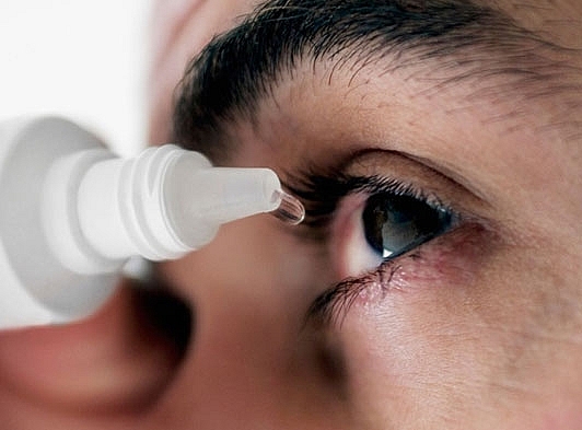 người nghi bị bệnh đau mắt đỏ cần đến các cơ sở chuyên khoa mắt để được khám và hướng dẫn điều trị; cần lưu ý để tránh lây bệnh cho người khác và cộng đồng.