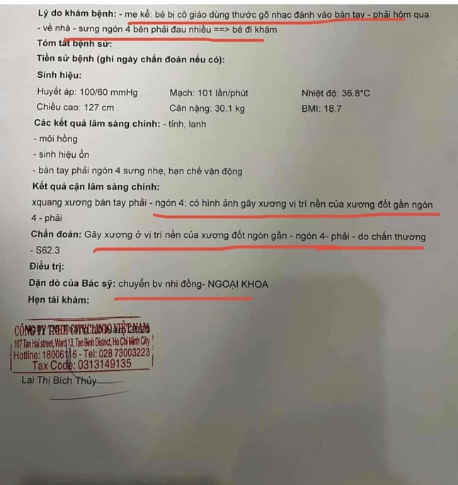 Kết quả chụp X-Quang cho thấy, bé  bị gãy xương ở vị trí nền của xương đốt ngón gần ngón 4 xương bàn tay phải