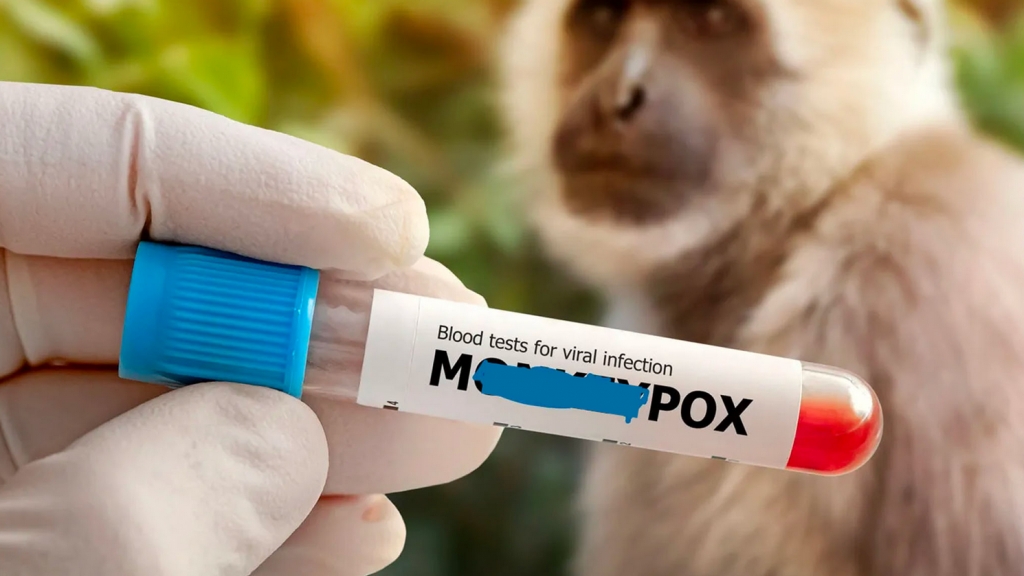 WHO cảnh báo khẩn về mối đe dọa của bệnh đậu mùa khỉ