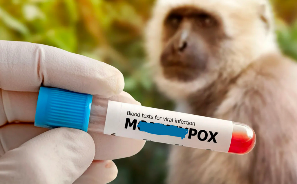 WHO cảnh báo khẩn về mối đe dọa của bệnh đậu mùa khỉ