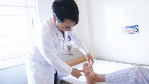 Biến dạng tay chân vì bệnh Gout