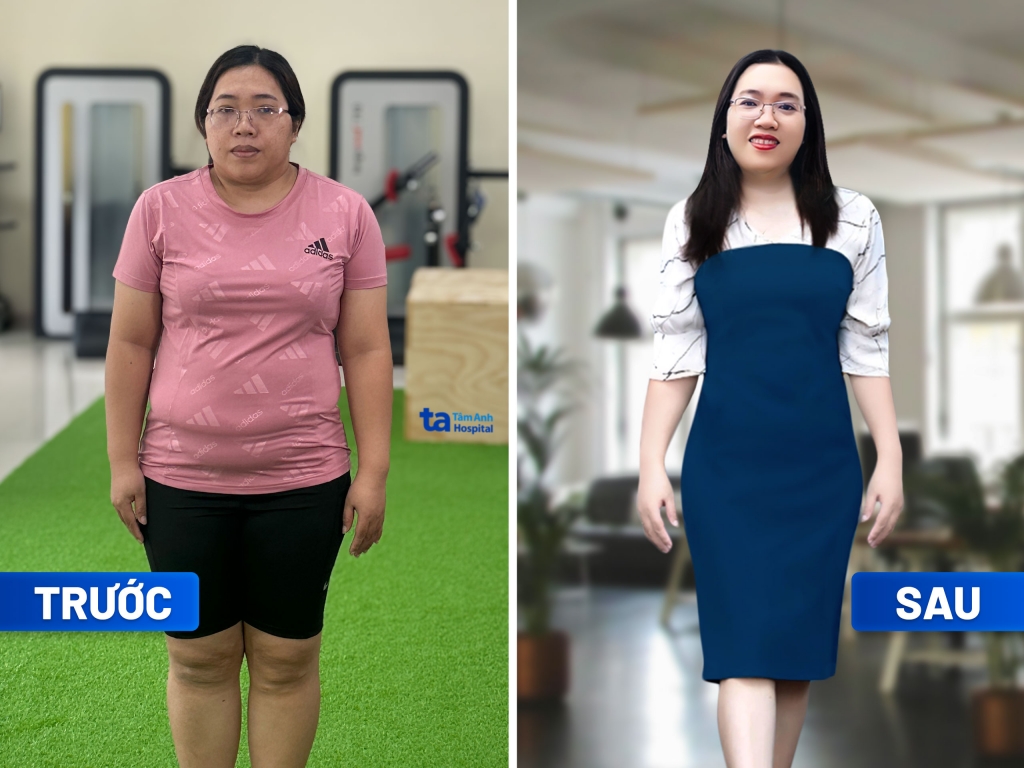 Chị Phạm Thị Ánh Dương giảm 7kg trong 3 tháng tại Trung tâm Giảm cân Tâm Anh. Chị không thấy mệt, không mất sức, không kiêng ăn quá mức, không bị stress. Ảnh: BVĐK Tâm Anh.