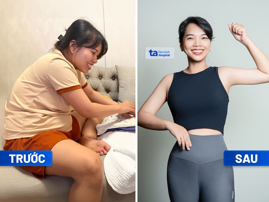 Chị Ngô Trần Thanh Thảo, giảm 10kg, đẩy lùi mỡ nội tạng. Chị cho biết giảm cân không thấy mệt, chi phí rẻ hơn gói tập gym. Ảnh: BVĐK Tâm Anh