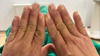 Căn bệnh lạ khiến người phụ nữ đau đớn mỗi khi chạm vào nước