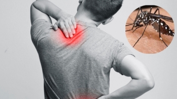 Nguy cơ dịch Chikungunya xâm nhập: Bộ Y tế cảnh báo và tăng cường biện pháp phòng chống