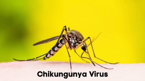 Phân biệt sốt Chikungunya và sốt xuất huyết
