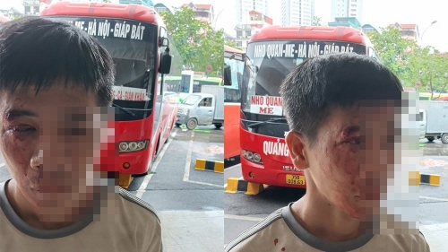 Hỏi hành khách "đi về đâu?", phụ xe bị đấm phải khâu 2 mũi