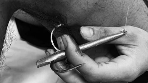 Sai lầm trong khi câu cá, nam thanh niên phải nhập viện cấp cứu