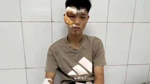 Hai đối tượng tông cảnh sát cơ động đối diện án phạt cao nhất?