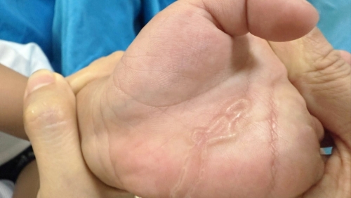 Bé trai nhiễm sán máng sau trò chơi tưởng chừng vô hại