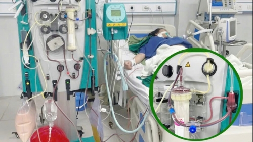 Cứu sống sản phụ bị viêm tụy cấp khi đang chuyển dạ