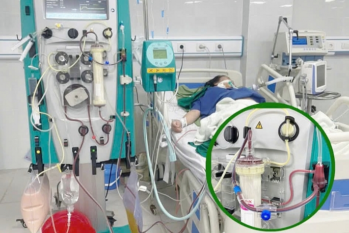 Cứu sống sản phụ bị viêm tụy cấp khi đang chuyển dạ