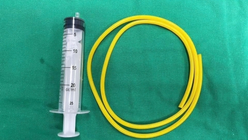 Gắp thành công dị vật dài 1 mét mắc kẹt trong bàng quang người đàn ông