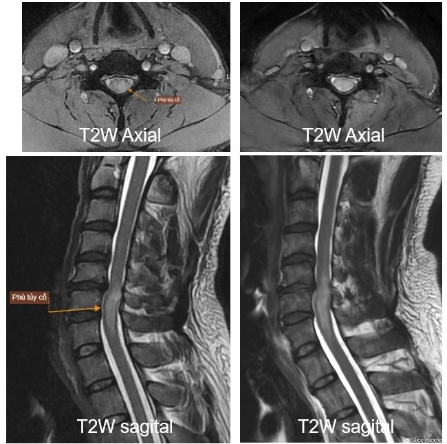 Hình ảnh chẩn đoán qua chụp MRI tại Bệnh viện Mặt Trời Hình ảnh chẩn đoán qua chụp MRI tại Bệnh viện Mặt Trời