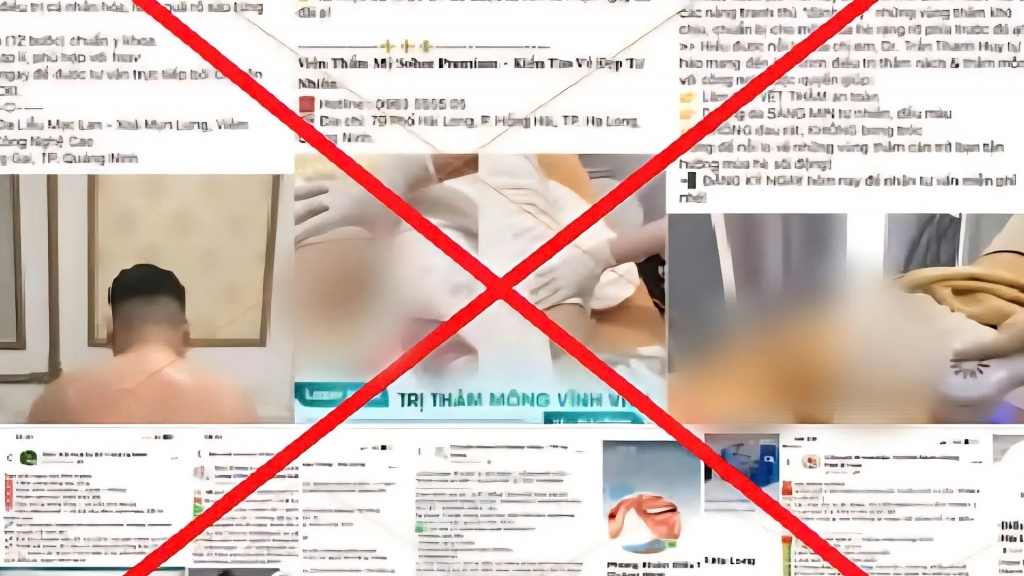 Kỳ 3: Những mắt xích ngầm nuôi sống thẩm mỹ chui