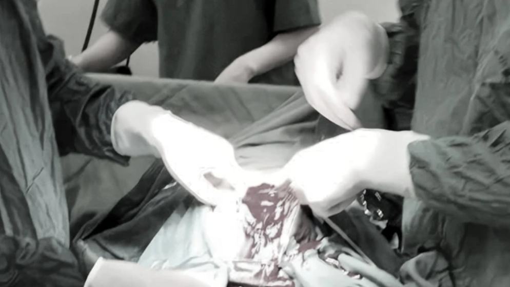 Suýt mất mạng vì tự ý phá thai bằng thuốc khi thai đã 33 tuần