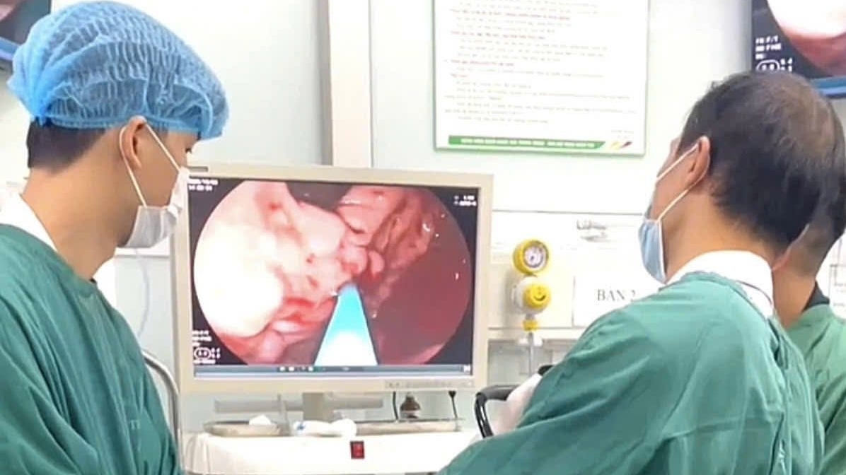 Nhập viện vì máu phun thành tia trong dạ dày sau một thời gian đau bụng, đầy hơi