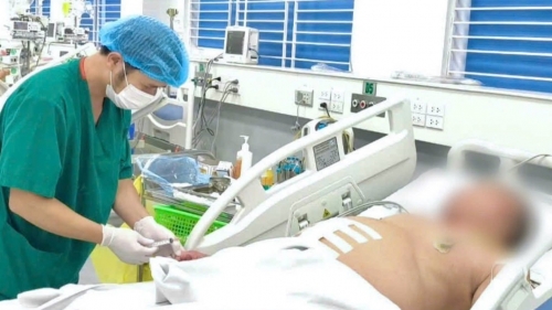 Thích ăn cá, người đàn ông nhập viện cấp cứu vì thủng ruột