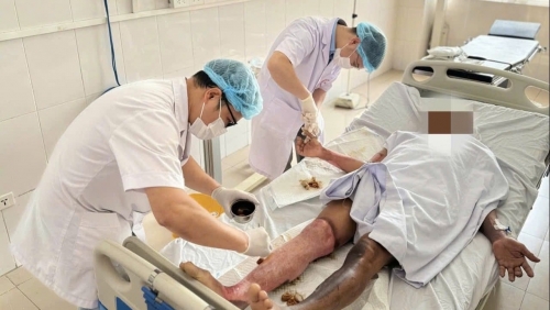 Không chạm vào dây điện vẫn bị bỏng nặng, nguy cơ từ tia hồ quang điện