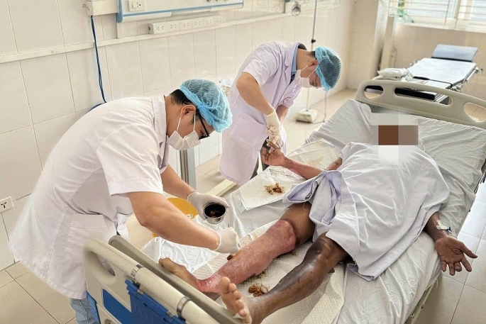 Không chạm vào dây điện vẫn bị bỏng nặng, nguy cơ từ tia hồ quang điện