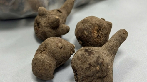 Cấp cứu kịp thời cụ bà 78 tuổi ngộ độc nặng do uống củ ấu tầu sống chữa đau khớp