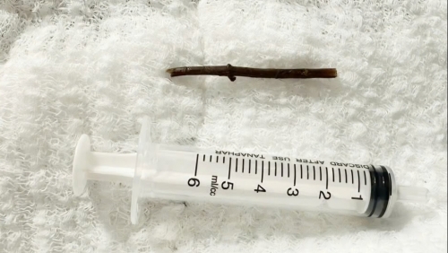 Người đàn ông bị thủng dạ dày sau khi uống thuốc lá tự sắc tại nhà