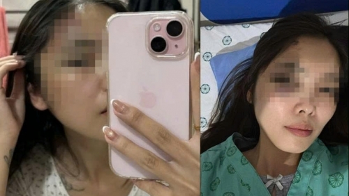 Điều tra vụ người phụ nữ ở Hà Nội bị chồng hành hung nhập viện với nhiều thương tích