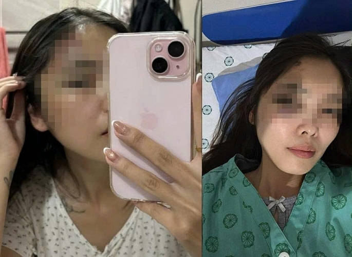 Điều tra vụ người phụ nữ ở Hà Nội bị chồng hành hung nhập viện với nhiều thương tích Điều tra vụ người phụ nữ ở Hà Nội bị chồng hành hung nhập viện với nhiều thương tích