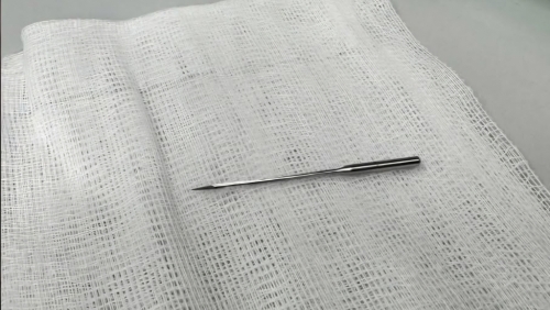 Bé trai 11 tuổi nuốt kim may dài 4cm, bác sĩ kịp thời nội soi gắp dị vật