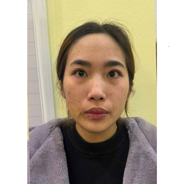 Đối tượng bị bắt giữ. Ảnh: CQCA Đối tượng bị bắt giữ. Ảnh: CQCA