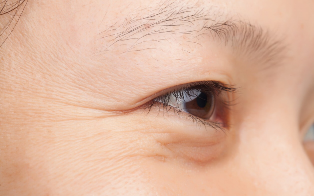 5 dấu hiệu cho thấy làn da đang lão hóa nhanh hơn tuổi thật