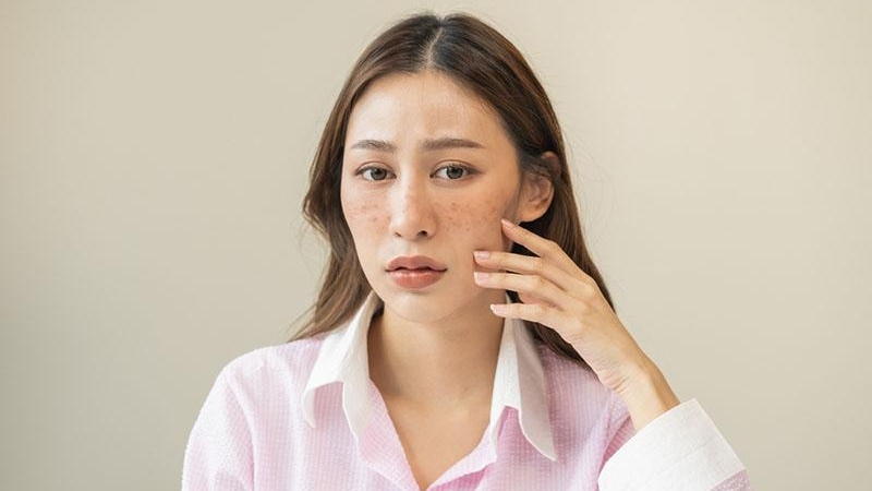 5 dấu hiệu cho thấy làn da đang lão hóa nhanh hơn tuổi thật