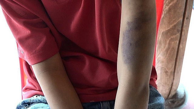 Bé trai bị bố và mẹ kế đánh tím đen cơ thể vì đi đá bóng be trai bi bo va me ke danh tim den co the vi di da bong