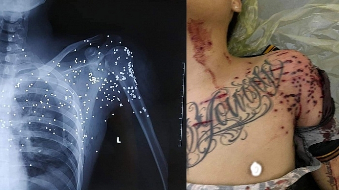 nam thanh nien bi nguoi la cam sung hoa cai ban nguy kich o tram bot