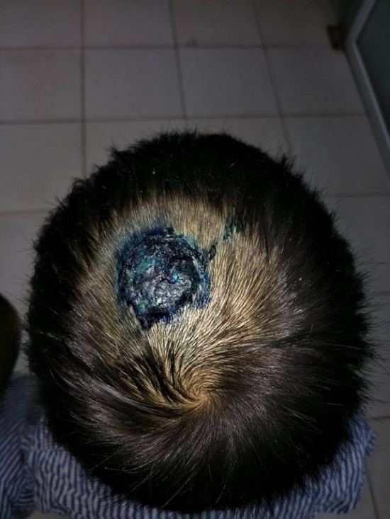 giat minh tre bi nam to ong do lay tu cho meo