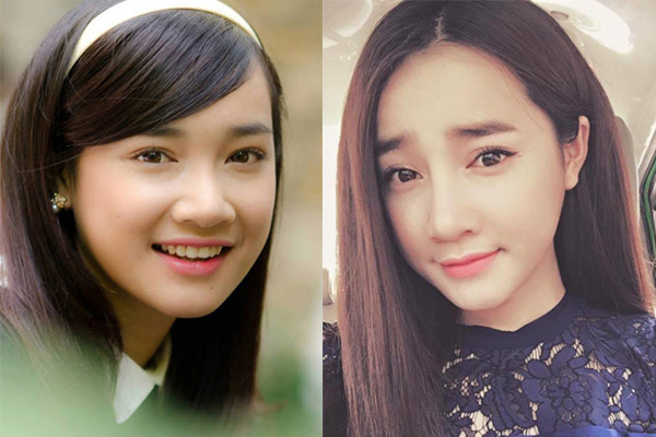 Nhã Phương ngày càng khác lạ với mũi cao, cằm nhọn bất thường